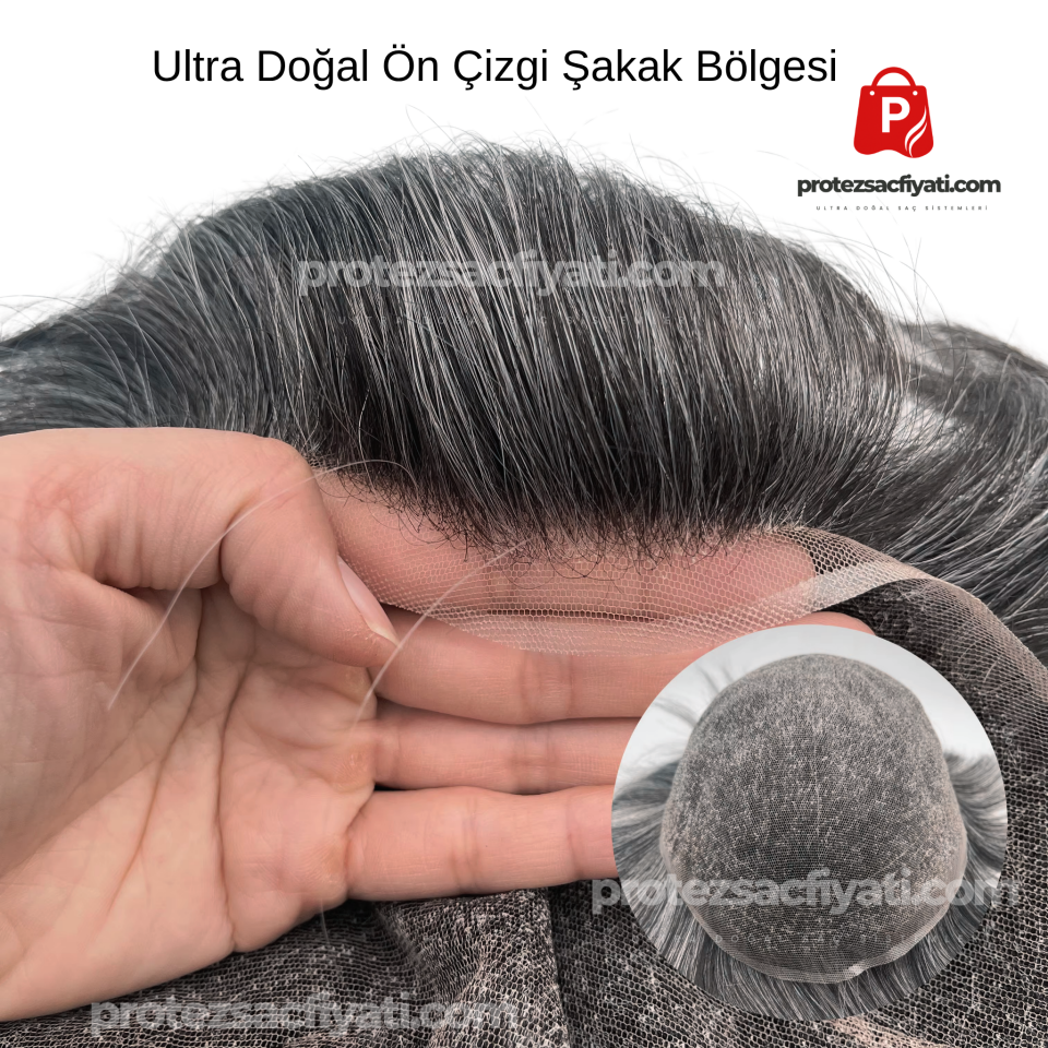 %20 Kırlı(Beyaz) Protez Saç Ultra Doğal  8x10 Ölçü Nano System %100 İnsan Saçı İnce Ten Görünümü