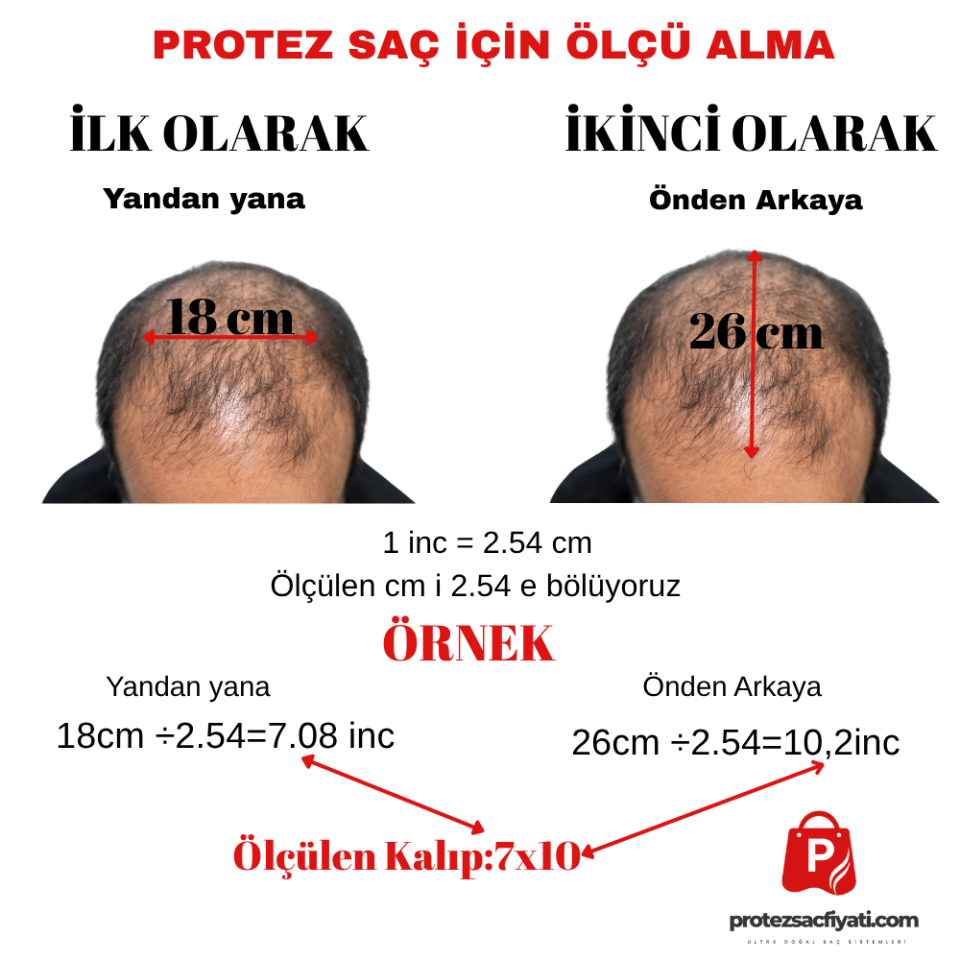 %20 Kırlı(Beyaz) Protez Saç Ultra Doğal  8x10 Ölçü Nano System %100 İnsan Saçı İnce Ten Görünümü