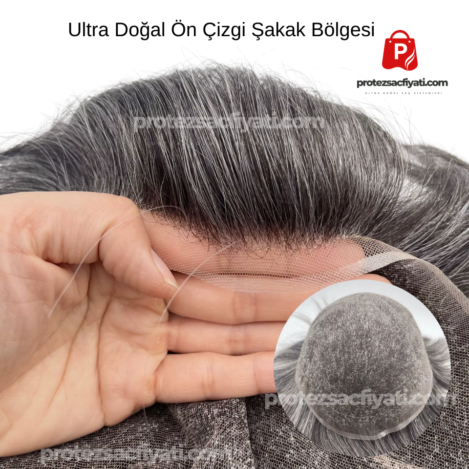 %30 Kırlı(Beyaz) Protez Saç Ultra Doğal 8x10 Ölçü Nano System %100 İnsan Saçı İnce Ten Görünümü