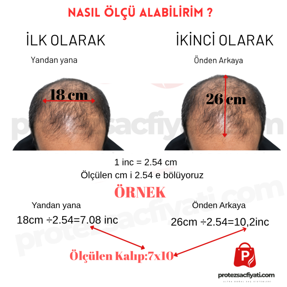 U.S American System Protez Saç 7x10 Ultra İnce Ultra Ten Görünümü